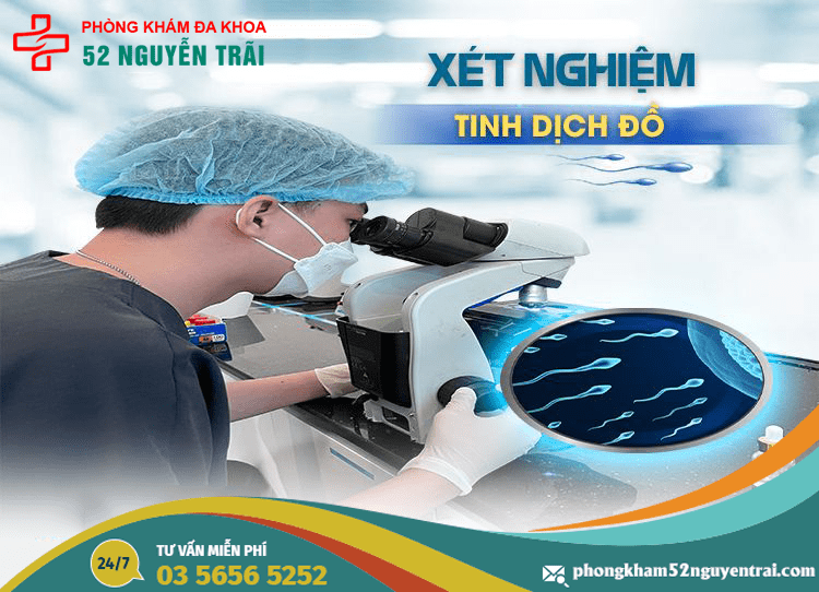 Xet-nghiem-tinh-dich-do-la-gi