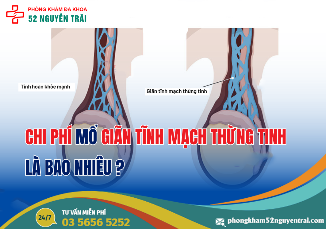 chi-phi-mo-gian-tinh-mach-thung-tinh