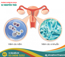 viem-am-dao-do-nam-hay-vi-khuan-phan-biet-nhu-the-nao