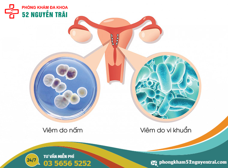 viem-am-dao-do-nam-hay-vi-khuan