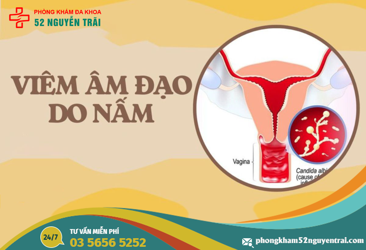 viem-am-dao-do-nam